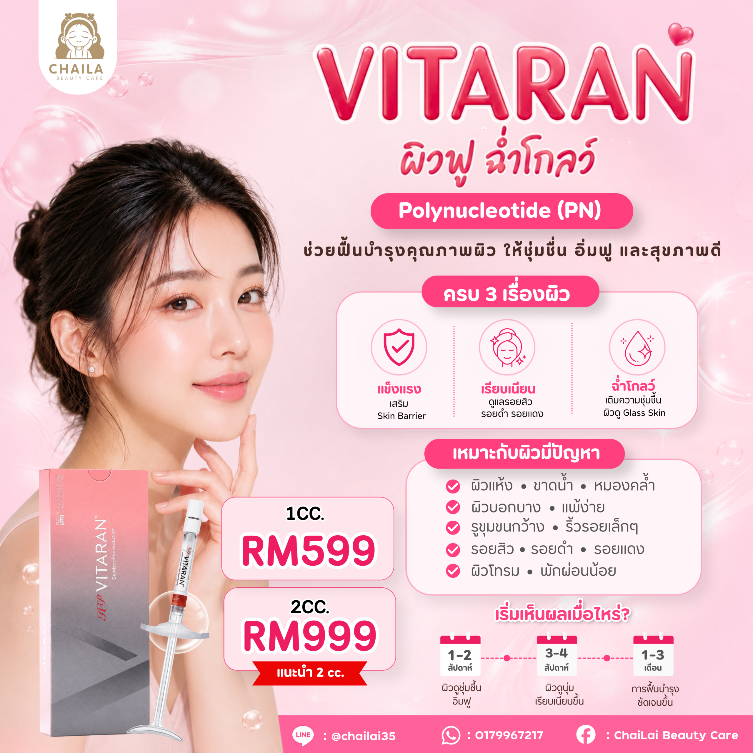 VITARAN