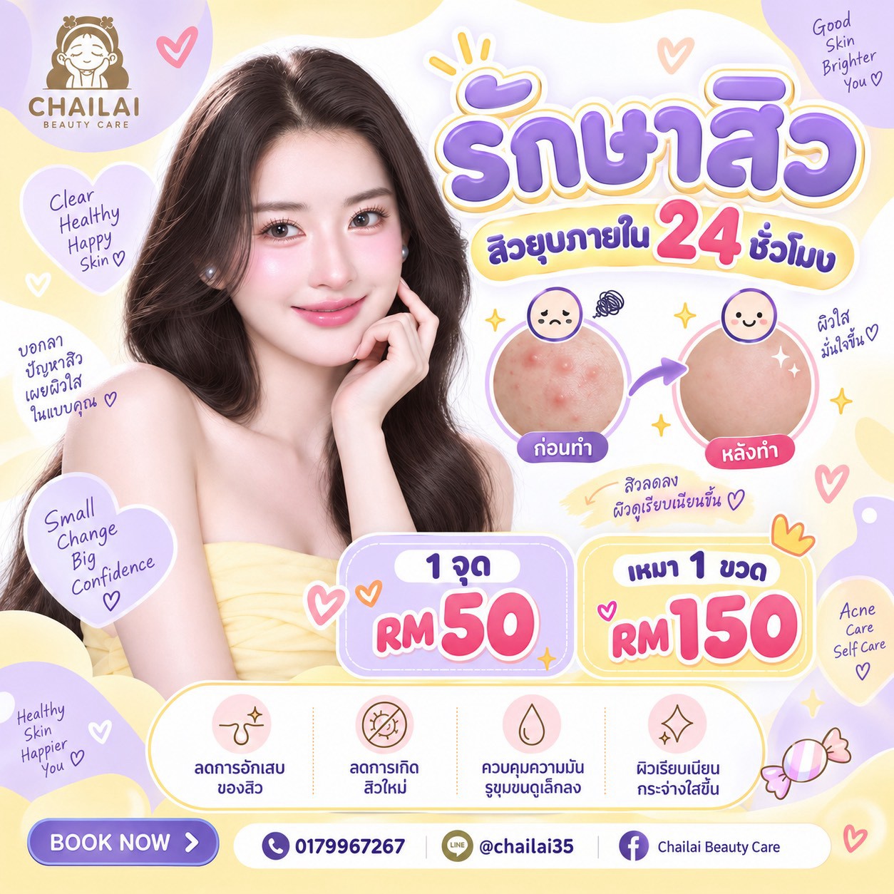 LINE_ALBUM_รักษาสิว_260911_1 - Copy